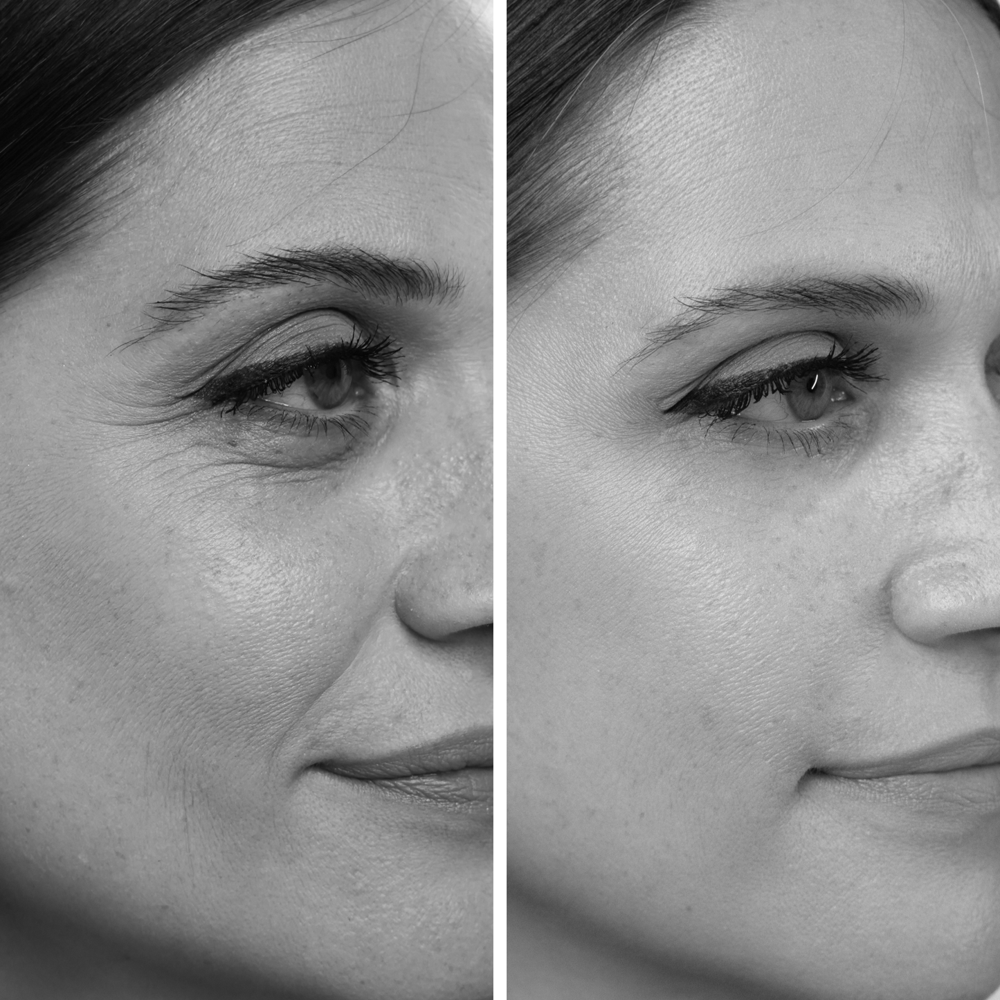 probaskin serum (ch)