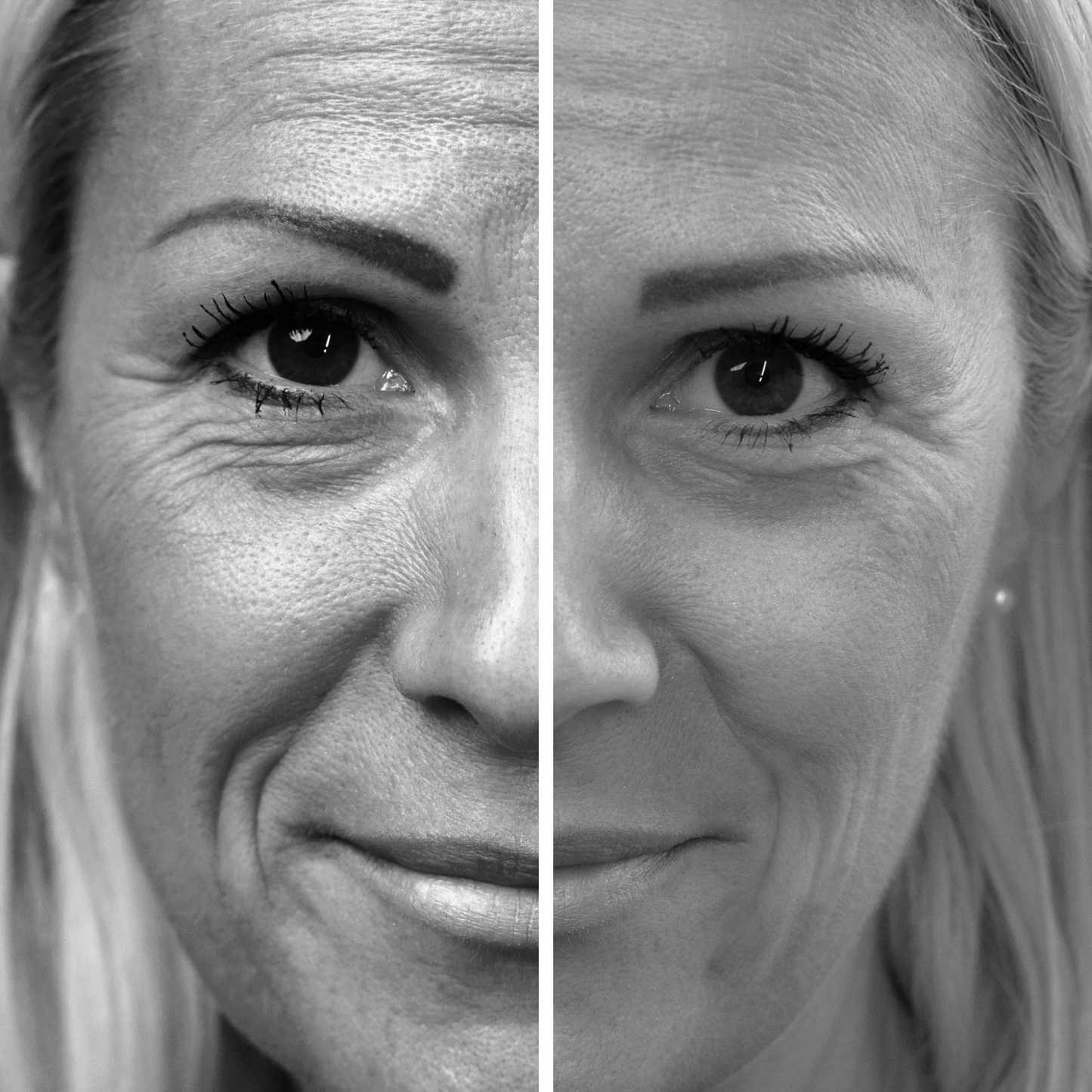 probaskin collagen shots (ch)